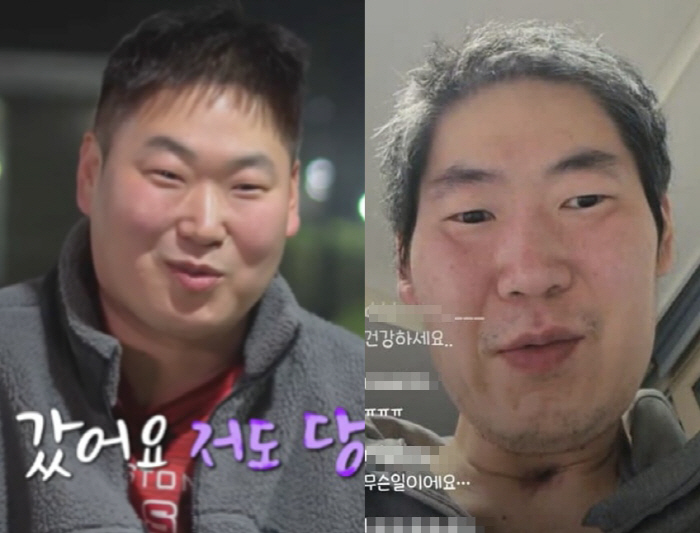 너무 야윈 19기 영철, 투병 탓 목에 삽관까지..안타까운 근황