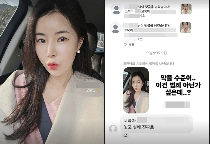 '코 성형' 10기 영숙, 욕설 악플+협박에 충격 "이건 범죄"