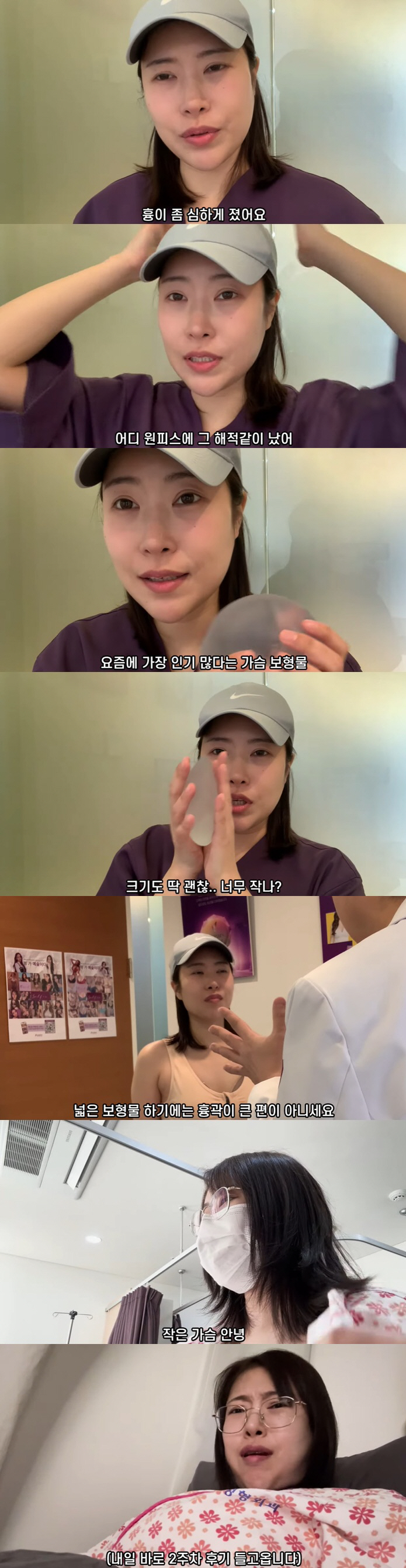 '가슴필러 터진' 이세영, 결국 재수술 받았다..'A컵→E컵' 변신 ('…