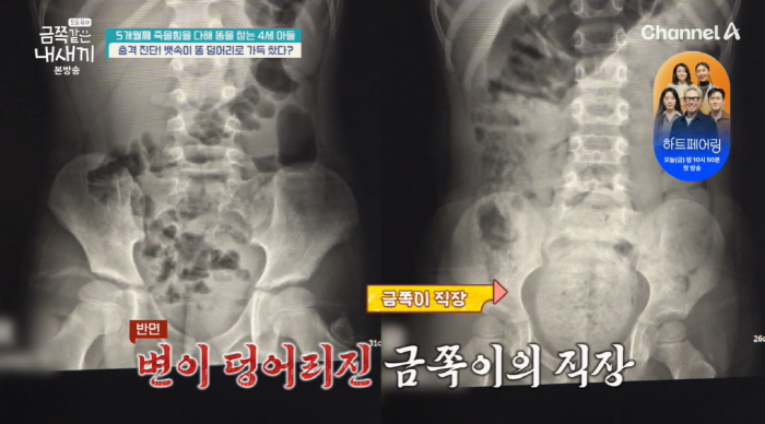 4세 금쪽이, 5개월째 대변 참다가 탈진 "가스 때문에 구토, 응급실行" ('금쪽같은 내새끼')[종합]