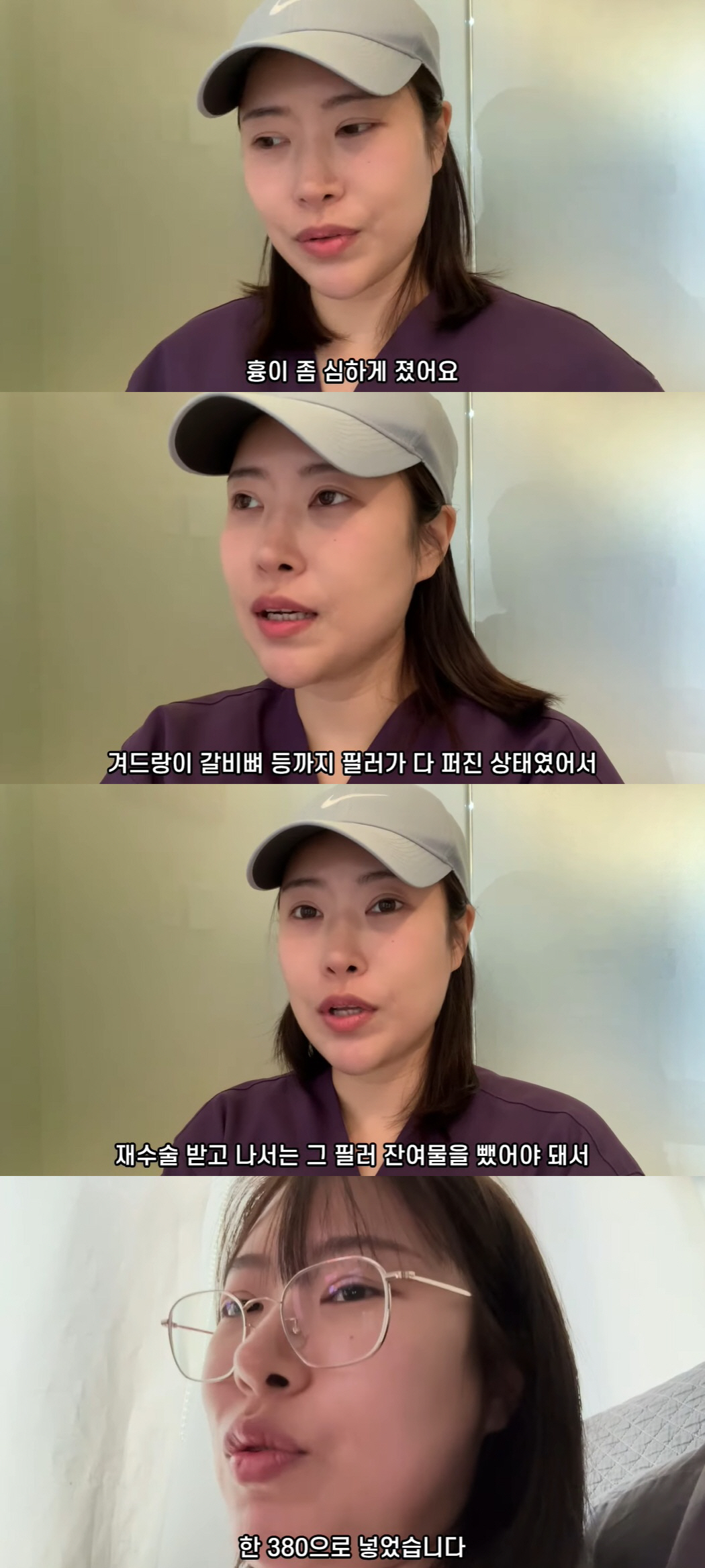 '가슴 재수술' 이세영, A컵서 E컵 됐다 "터진 필러는 다 긁어내" (…