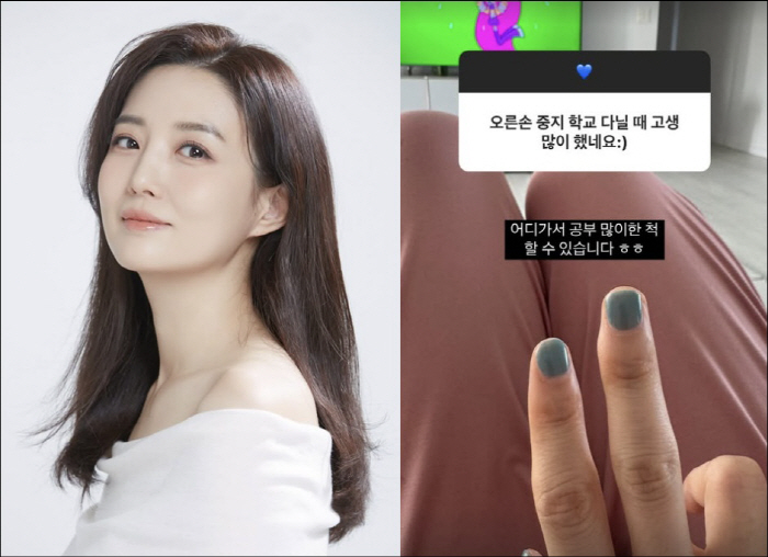 '오상진♥' 김소영, 사법고시도 준비했다더니…손가락 변형에 깜짝 "고생 많이 했네"