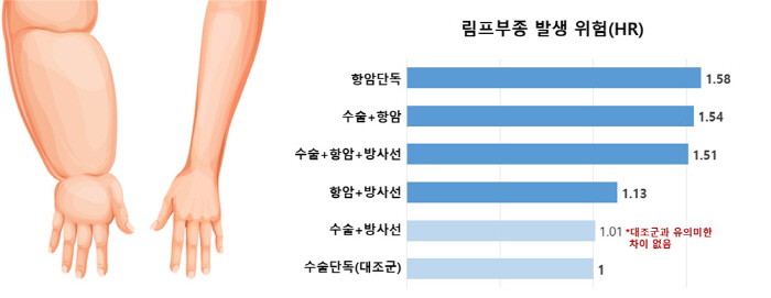 "유방암 수술·항암화학요법 병행, 림프부종 위험 1.5배 높아"