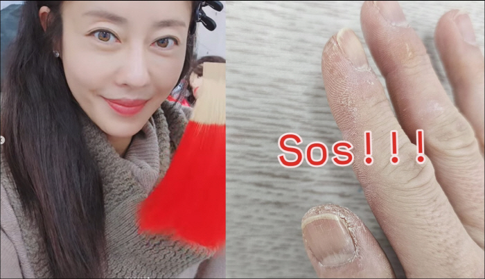 '싱글맘' 이지현, 심각한 손 상태에 고통 호소…결국 SOS까지 "너무 아파"