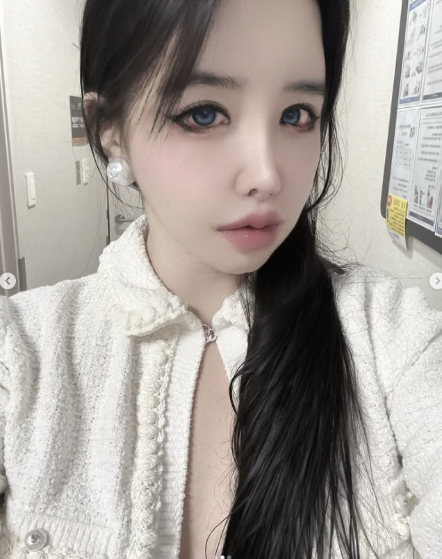 박봄, 또 무슨 일…새빨갛게 충혈된 눈에 팬들 또 걱정 "건강 챙겨요"