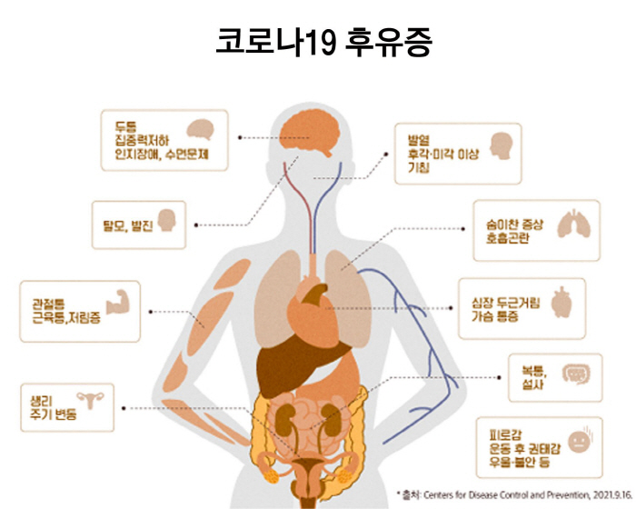 "코로나19 환자 23%는 '롱코비드'…여성이 더 위험"