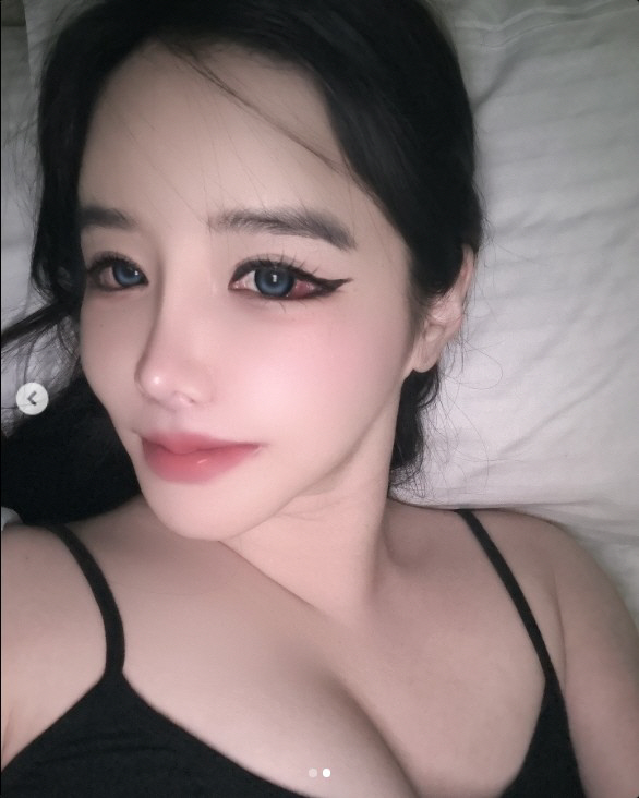 박봄, 눈에 실핏줄은 다 터졌는데...멈추지 않는 SNS에 팬들은 '걱정…
