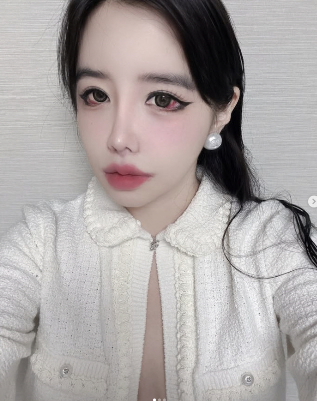 박봄, 눈에 실핏줄은 다 터졌는데...멈추지 않는 SNS에 팬들은 '걱정…