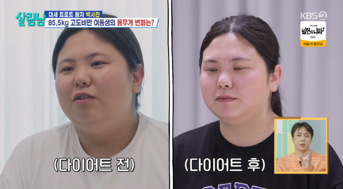 박서진, 얼굴 성형에 1억 들였는데…요요로 변한 '이중턱' 충격(살림남)