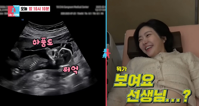 "혹시 그거 보이나요?" 레이디제인♥임현태, '15주 쌍둥이' 성별 첫 공개 ('동상이몽')