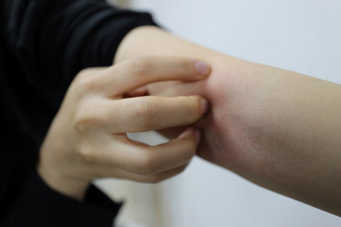 "왜 가렵나 했더니…" 환절기 아토피피부염 주의