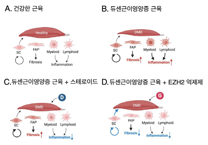 희귀질환 '듀센근이영양증' 새 치료 전략 제시…EZH2 억제제+스테로이드 병행 효과적