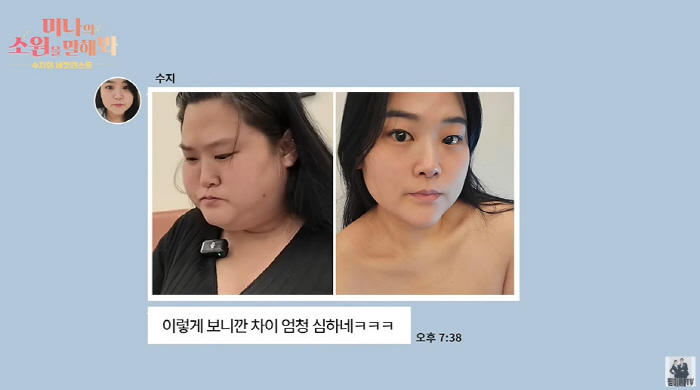 '미나 시누이' 수지, '60kg 감량+시술' 후 사라진 팔뚝살+턱살 비교샷..."예뻐지고파" ('필미커플') [종합]