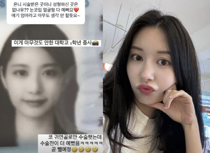 '이지훈♥'아야네, 자연미인인줄 알았는데..성형 전후 사진 공개 "귀 연…