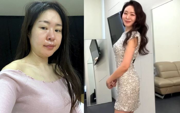 '김태현♥' 미자, 같은 사람이라고?...충격의 다이어트 전·후 "불과 …