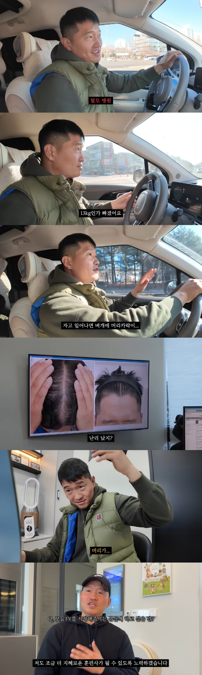 강형욱, 갑질논란 후 스트레스성 탈모 생겼다 "13kg 빠지기도"