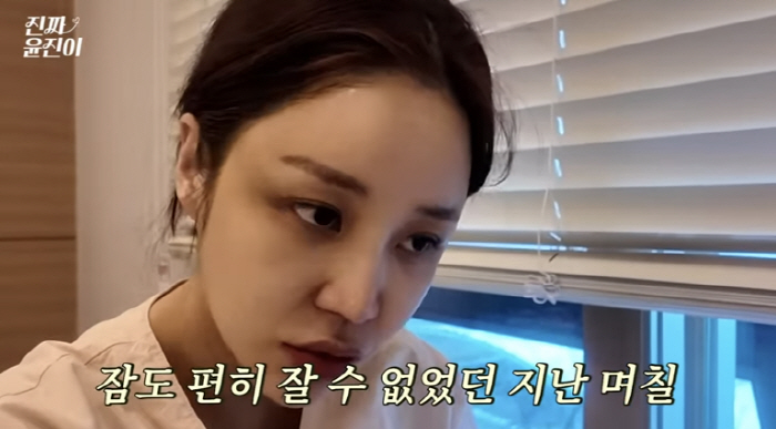 '화상 피해' 윤진이, 둘째 출산 후 진통제 투혼 "몸 쇠약해져, 잠도 못 자"