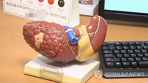 "'대사이상 지방간' 지속 시 심혈관질환 위험 57% 증가"