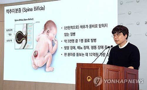 '3천명 중 1명' 선천성 척추이분증 원인 국내 연구팀 밝혀