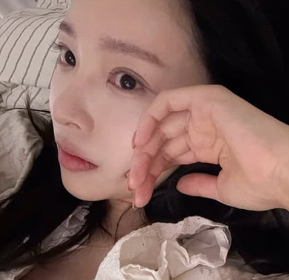 '박성광♥' 이솔이, 눈 성형했나..'확 달라진 눈매'에 의혹↑