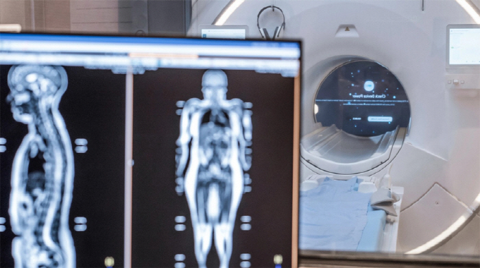 재미 삼아 MRI 검사받았는데, 치명적 질환 발견…"몸 안에 시한폭탄"