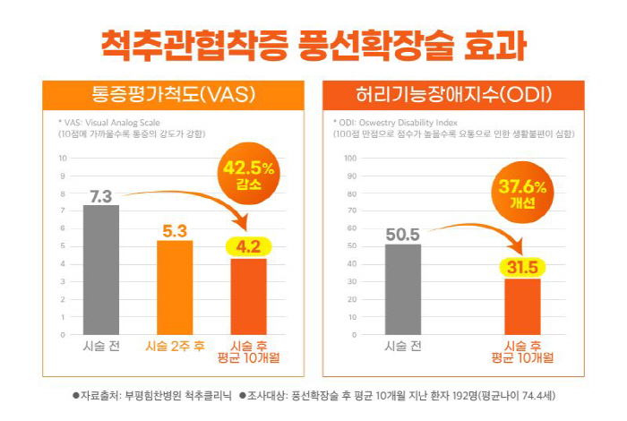 척추관협착증, '비수술' 풍선확장술 효과…부평힘찬병원 "통증 42.5% …