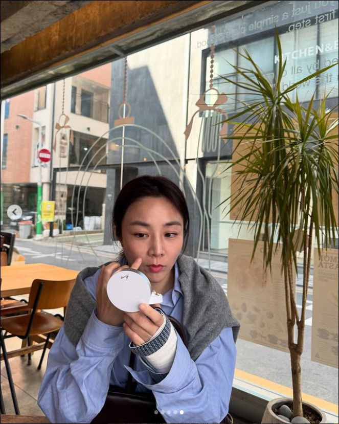 '조우종♥' 정다은, 뒤늦게 전해진 안타까운 사고 소식..."손목뼈 두 …