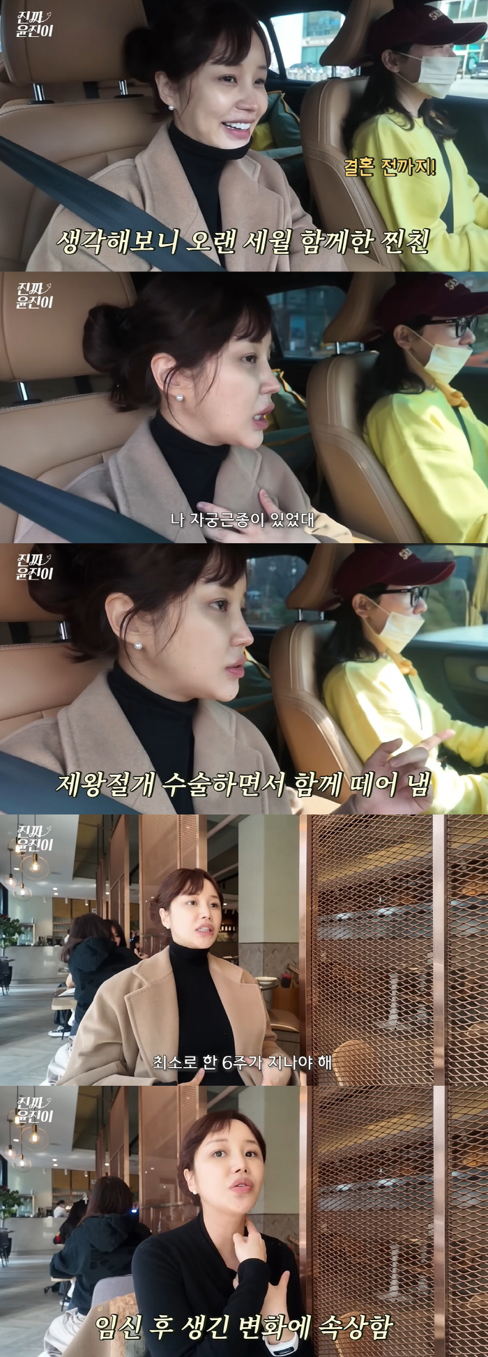 '둘째 출산' 윤진이, 자궁근종 발견 "제왕절개할 때 혹 보여"