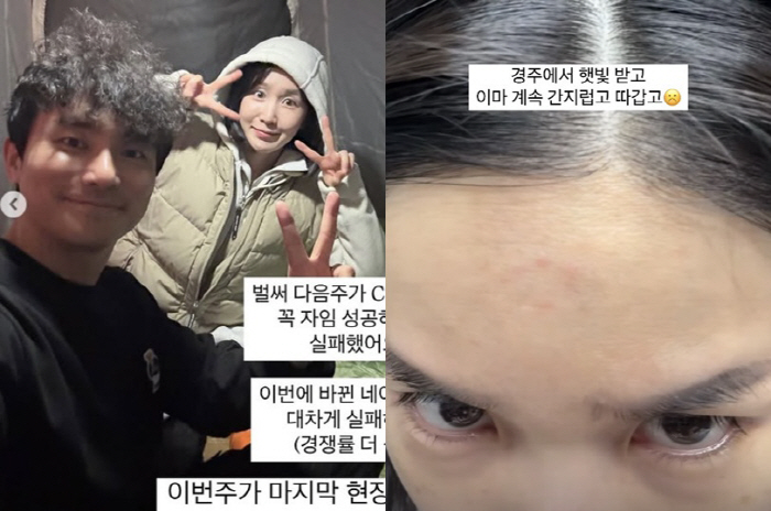 '난임 한의원' 찾은 초아, 부작용 토로 "간지럽고 따가워"