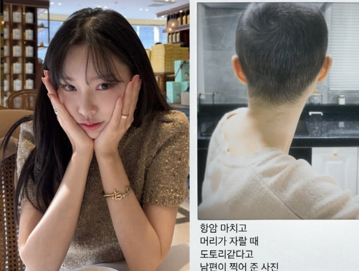 '암투병' 이솔이, 항암 후 짧아진 머리+암수술 당시 공개 "이제야 밝혀 후련"