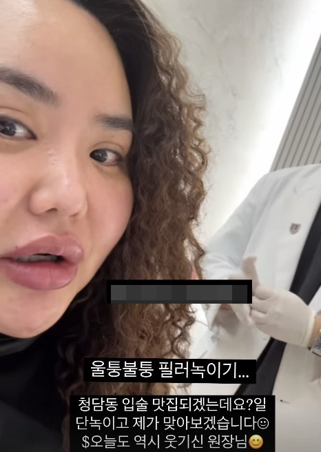 홍진영 언니 홍선영, 입술 필러 부작용 왔나…"울퉁불퉁 필러 녹인다"