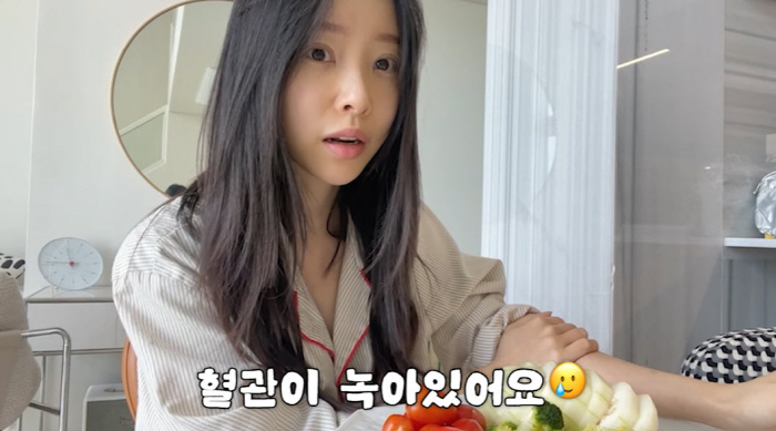 '박성광♥' 이솔이, 암 투병 후 남은 상처…"혈관 다 녹아"(이솔이)