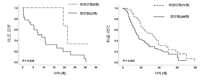 눈·콩팥 동시에 공격, 희귀병 'PAX2 유전자 변이' 유형따라 예후 달라