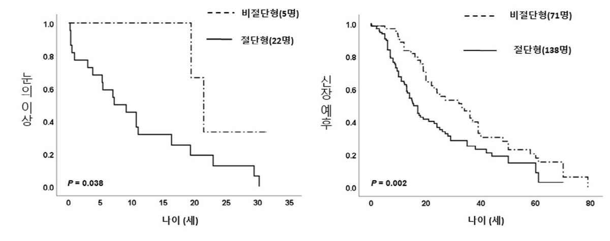 눈·콩팥 동시에 공격, 희귀병 'PAX2 유전자 변이' 유형따라 예후 달…