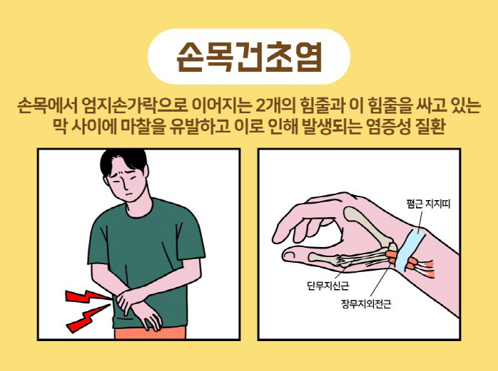 출산 후와 갱년기 때 손목 뻐근하고 시큰거리면 , '이 질환' 의심