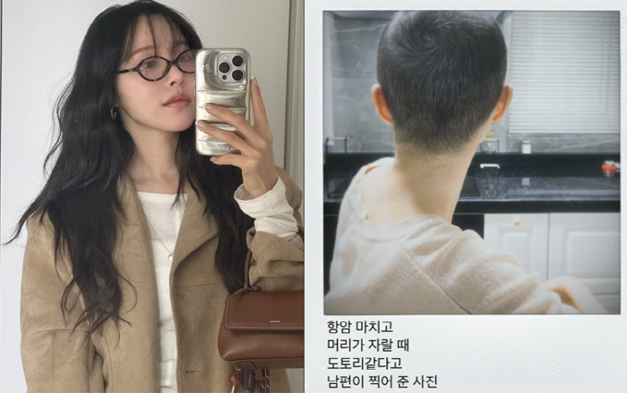 '박성광♥' 이솔이, '여성암 투병' 삭발 후 머리숱 고민..."치료 티…