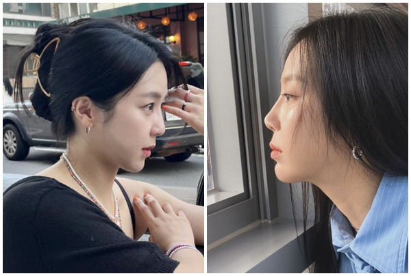 쥬얼리 예원, 얼굴 몰라보겠다 했더니…코 성형 고백 "왜 했냐고"[SC이슈]