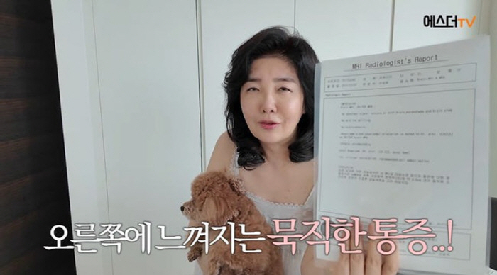 여에스더 투병 '뇌동맥류', 발생 원인과 증상 및 치료는?