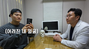 김종국, '성형외과 의사' 형에게 시술받고 변한 얼굴 