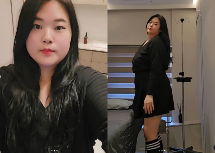 '이혼' 미나 시누이, 60kg 감량 후 명품 턱선..로또급 비주얼 변화