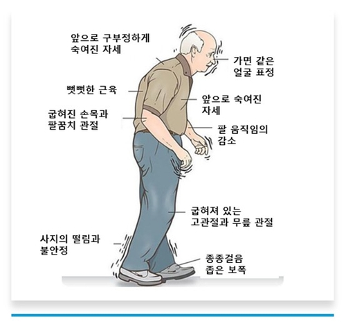 [대한파킨슨병 및 이상운동질환학회 제공]