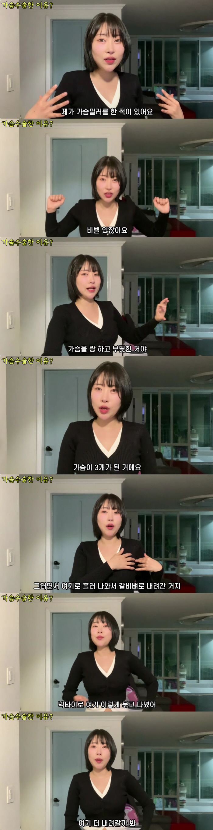 이세영, 가슴필러 대참사 "흘러내려 가슴 3개 돼, 넥타이로 묶고 다녔다…