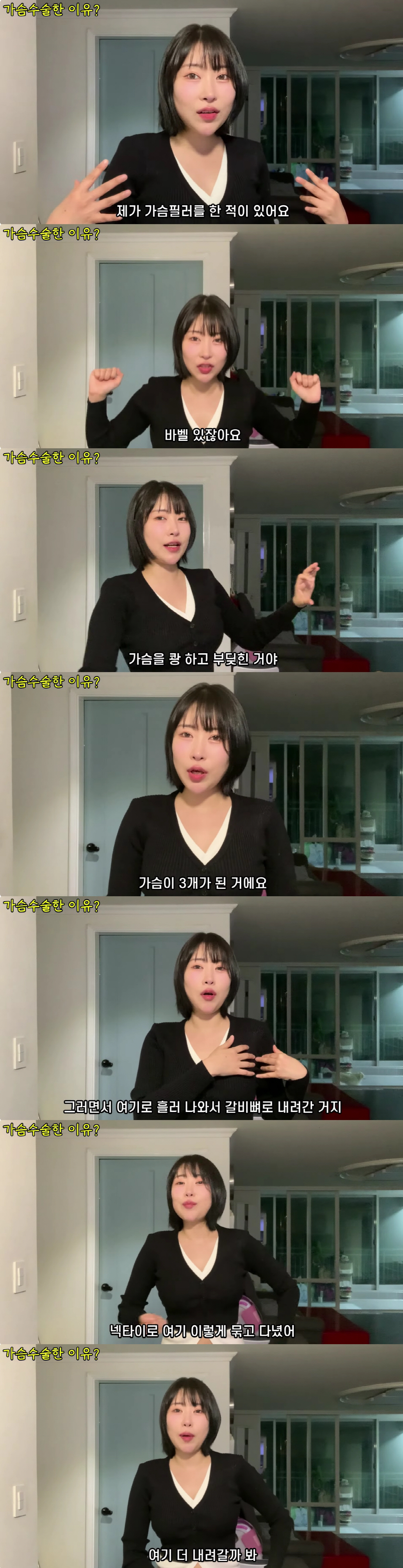 이세영, 가슴필러 대참사 "흘러내려 가슴 3개 돼, 넥타이로 묶고 다녔다…