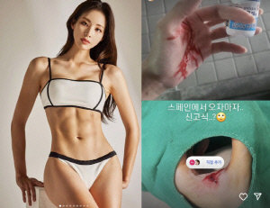 신수지, 피범벅 손 공개 