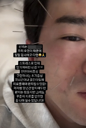 이민우, 얼굴 마비 증상 악화 고백 