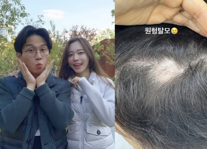 이솔이, '암투병 탓 삭발'했는데..박성광♥도 안타까운 소식