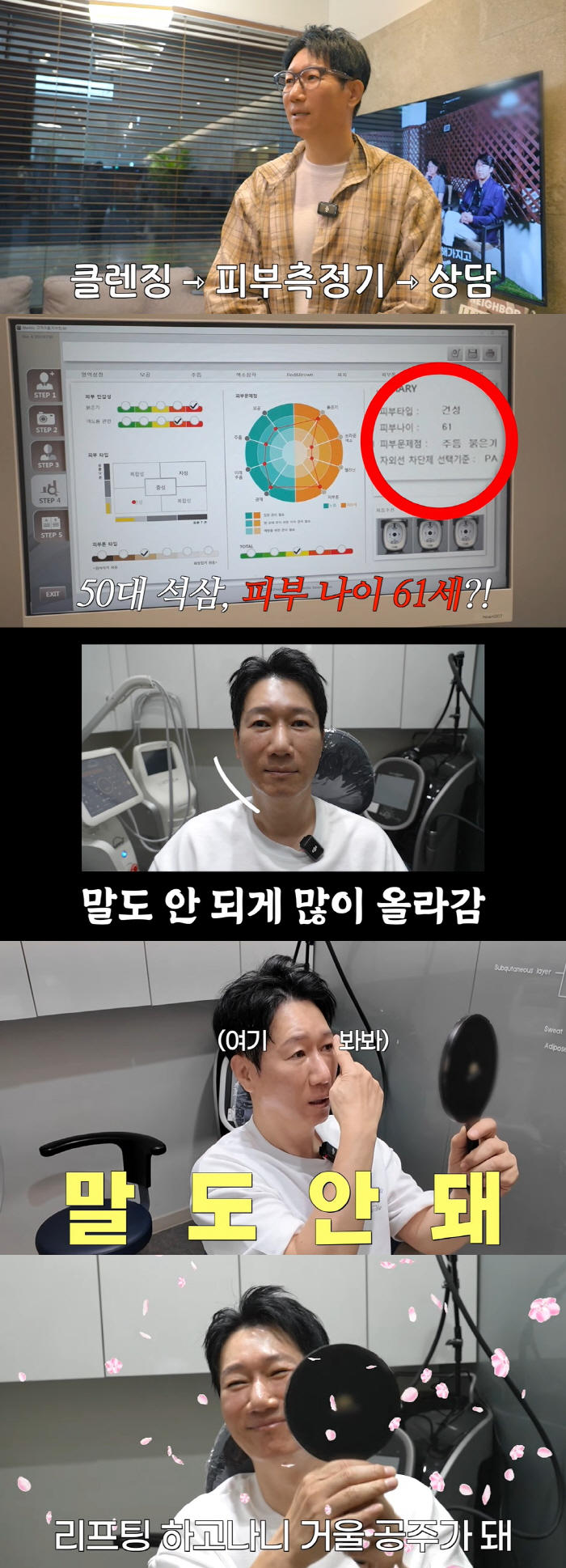 '59살' 지석진, 리프팅 시술 후 확 달라졌다 "입꼬리까지 올라가"