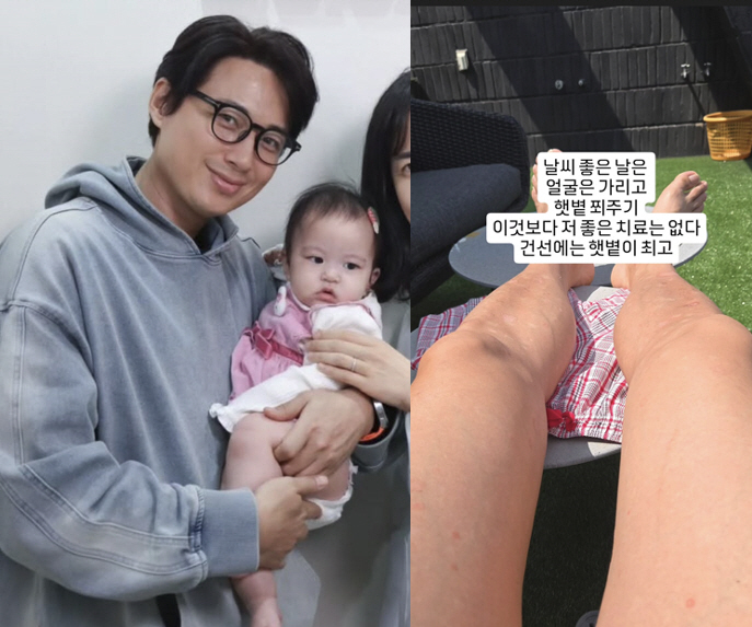 이지훈, 9개월 딸과 앓고 있는 피부병 고백 후...옥상서 "건선엔 햇볕이 최고"