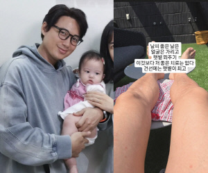 이지훈, 9개월 딸과 앓고 있는 피부병 고백 후...옥상서 