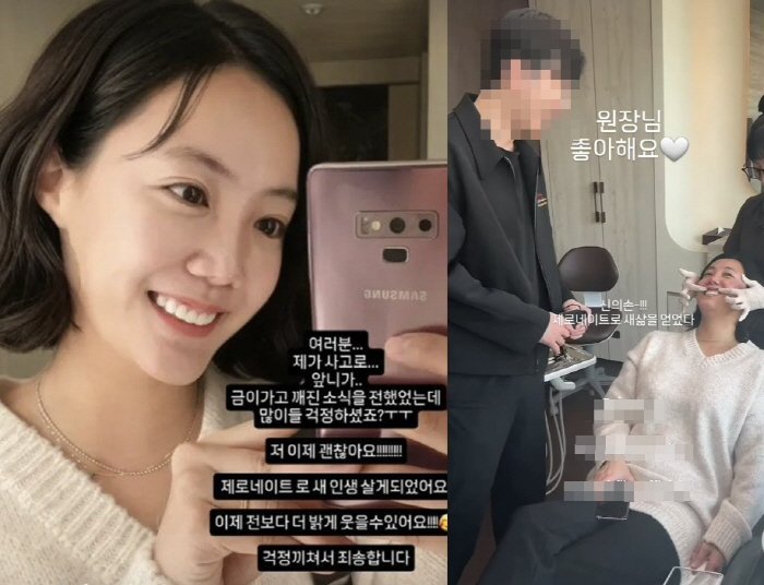 '낙상 사고' 고은아, 깨진 앞니 치료 후 '건치 미소' 활짝 "새 삶 …